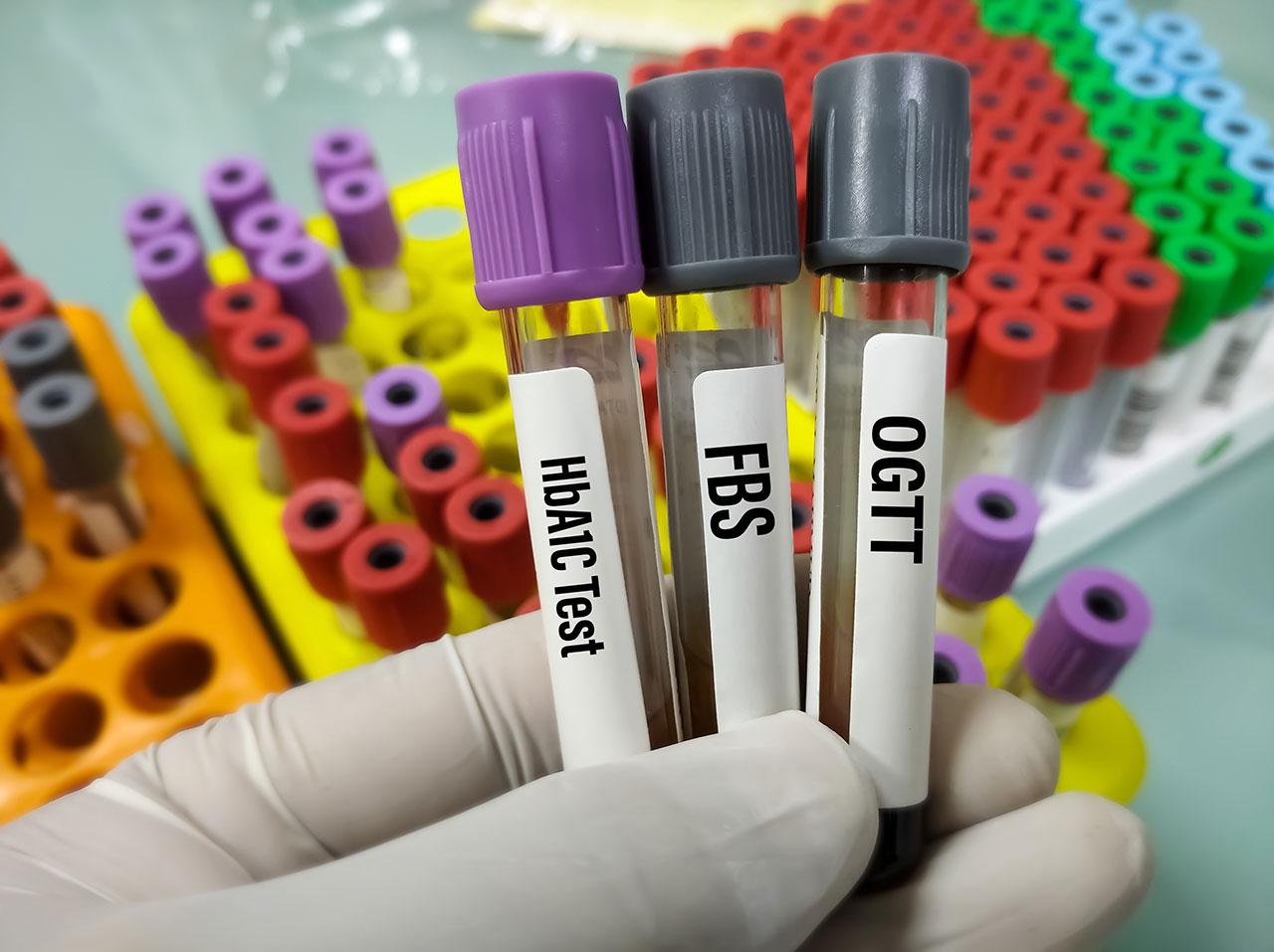 Tests-and-Diagnosis